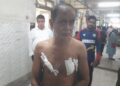 রামনগর ২ নম্বরে অবৈজ্ঞানিক ভাবে তৈরি করা স্মার্ট সিটি নির্মীয়মান কালবার্ড ড্রেইনে পরে গুরুতর আহত প্রাক্তন শিক্ষক মনোজ রায়। 